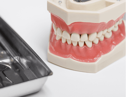 4 импланта + протез